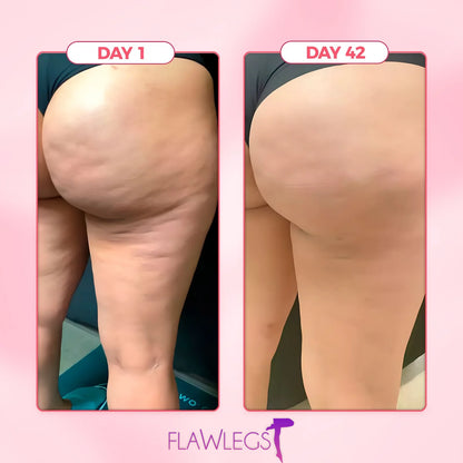 FlawLegs - Las Medias anticelulíticas de las famosas [COMPRA 1 Y LLEVA 3]